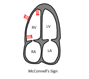 mcconnell diagram