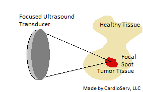 mechanism