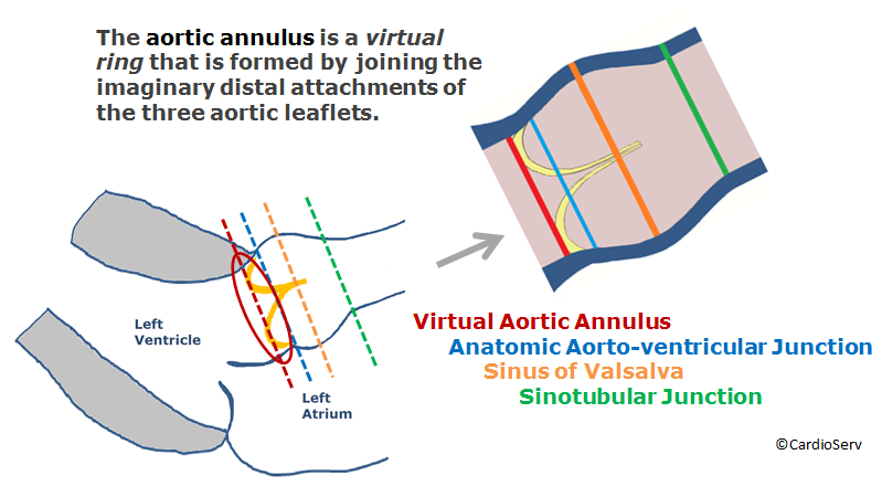 aortic annulus virtual ring