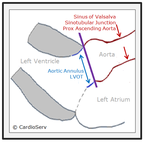 How to Master Aortic  Measurements with These 5 Techniques