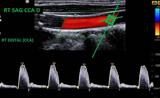 What’s wrong with this vascular image?