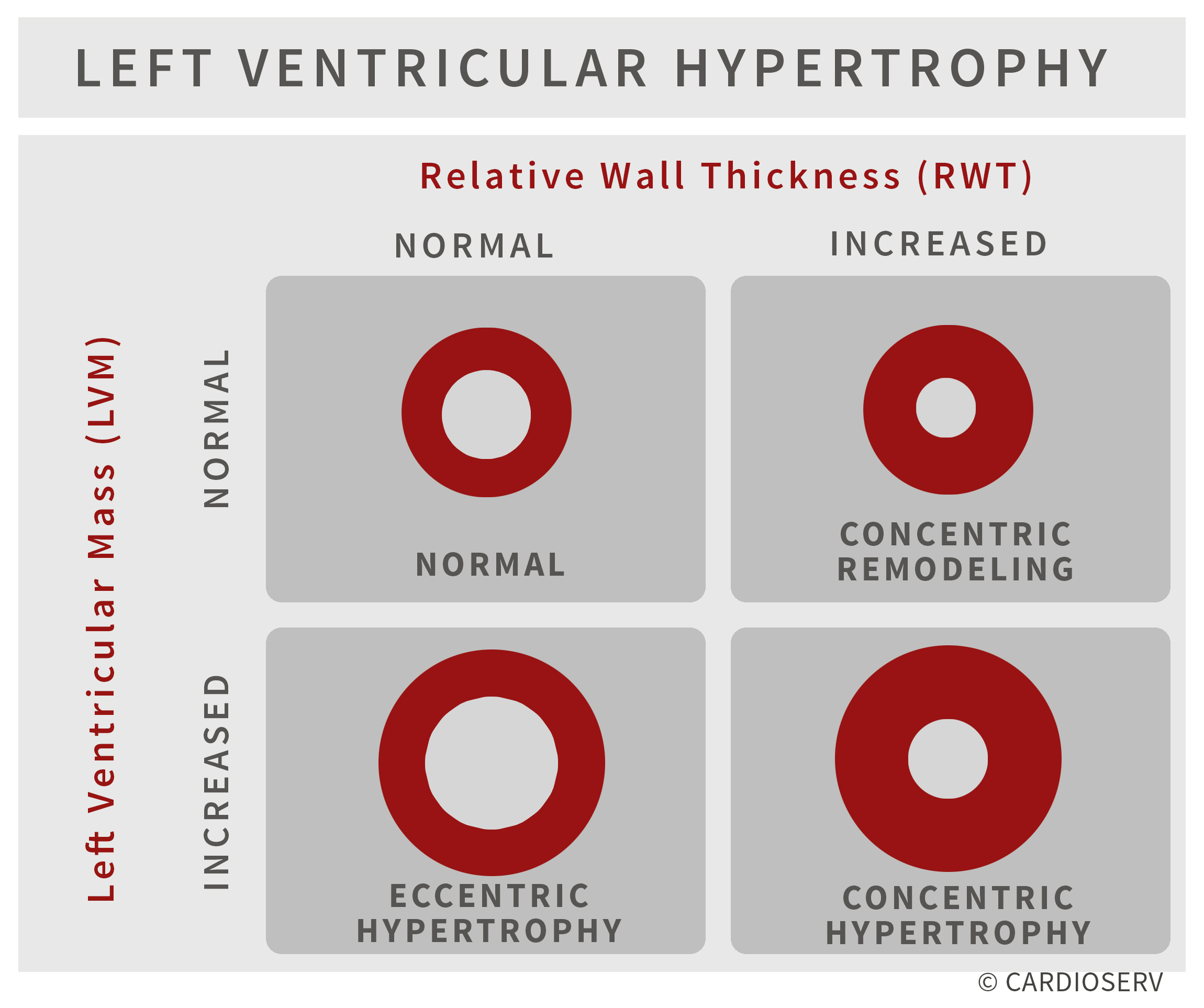 Understanding LVH Part 2: How to Measure LV Mass and Diagnose LVH