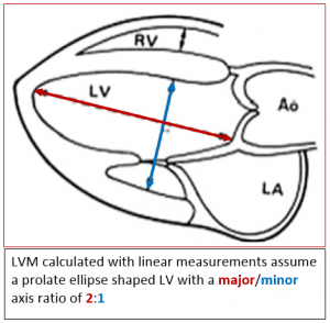 Understanding LVH Part 2: How to Measure LV Mass and Diagnose LVH