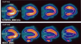 Essential Steps to Creating MPI Patient Centered Imaging Protocols