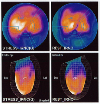 Patient Centered Imaging – 5 Ways to Reduce Radiation Exposure