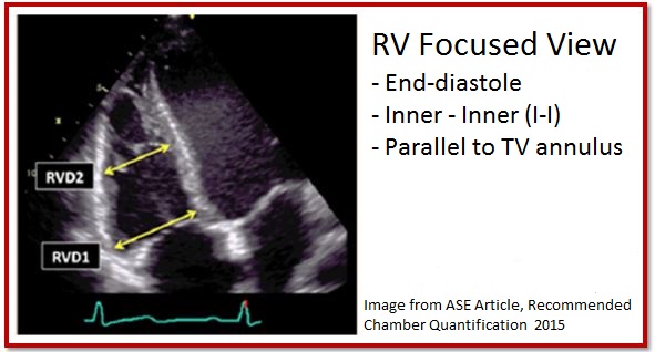 Right Ventricle Focused View