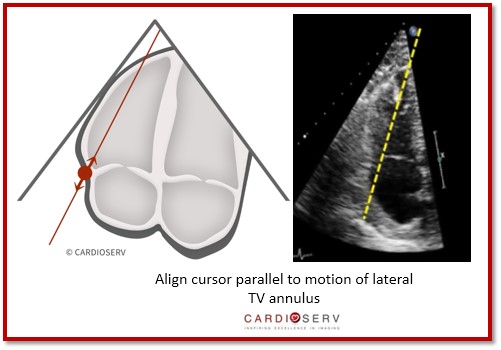 Cursor Alignment