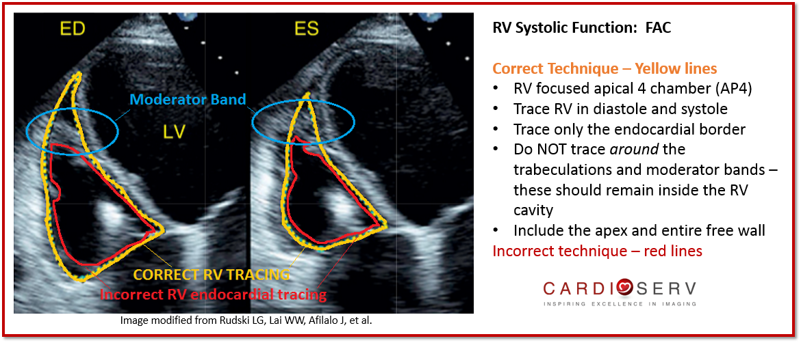 5 Things to Know about Using Fractional Area Change (FAC) to Assess RV Function