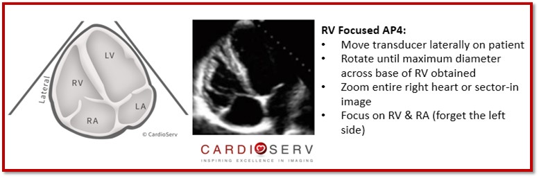 RV Focused AP4