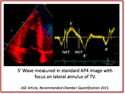 S Wave 