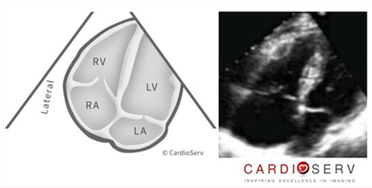 Introduction to Right Heart Assessment