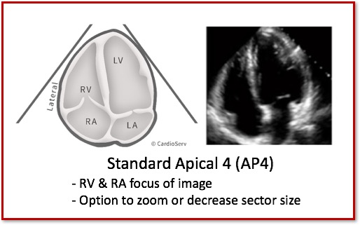 Improvement of left ventricular function assessment by global