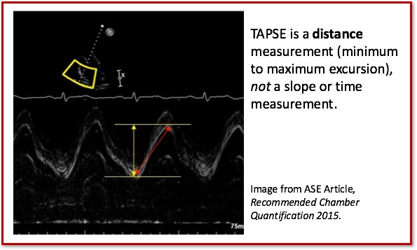 TAPSE Distance