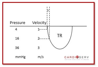 TR Velocity