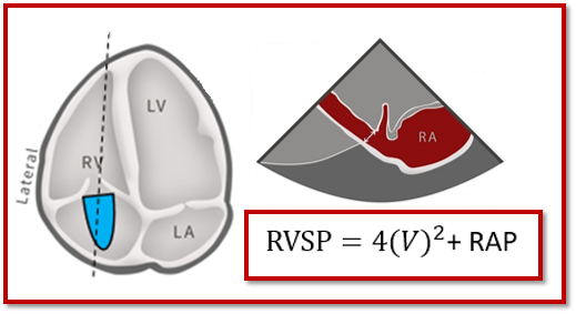 6 Tips for Calculating RVSP