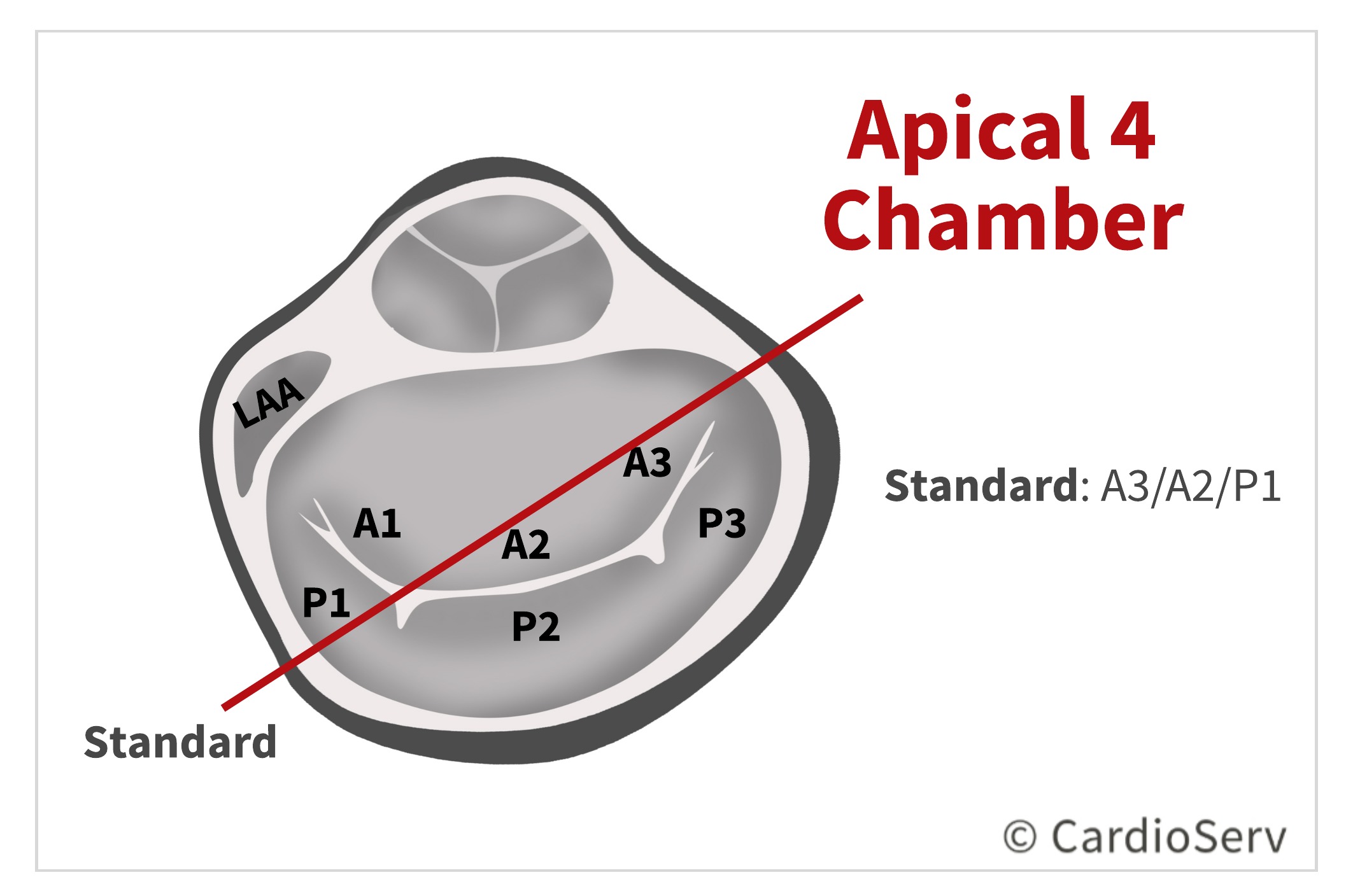 Apical 4 Chamber AP4 Mitral Valve Scallops Echo 