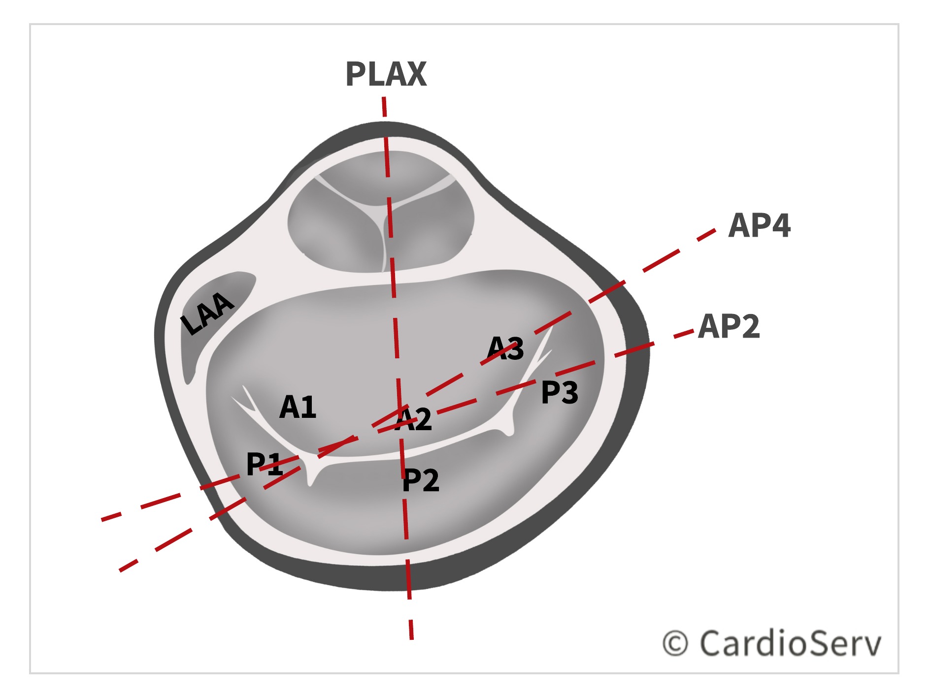 TTE Echo Mitral Scallops Identification