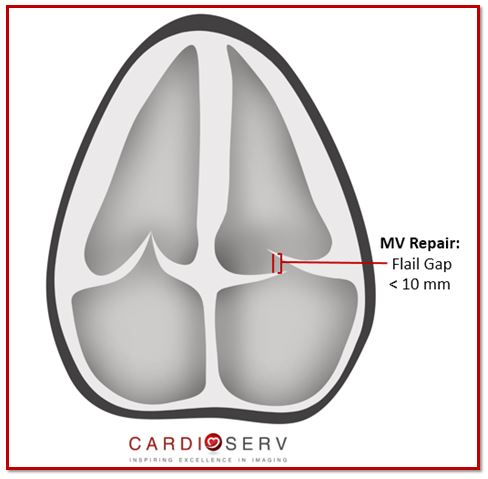 Mitral Valve Flail Measurement