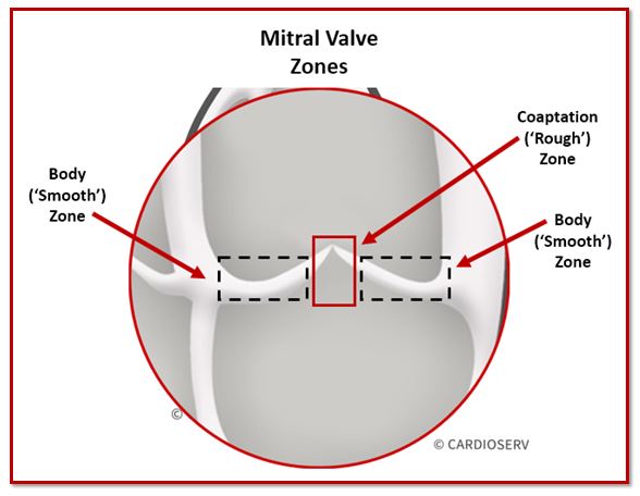 Mitral Valve Coaptation Zone