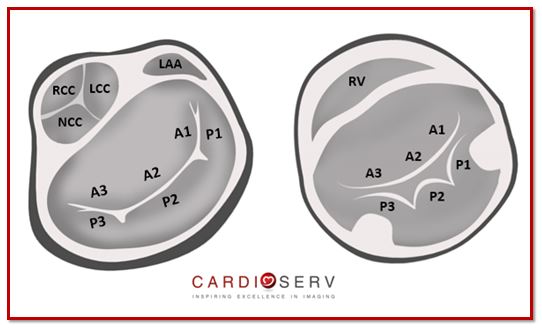 PSAX Mitral Valve Scallops