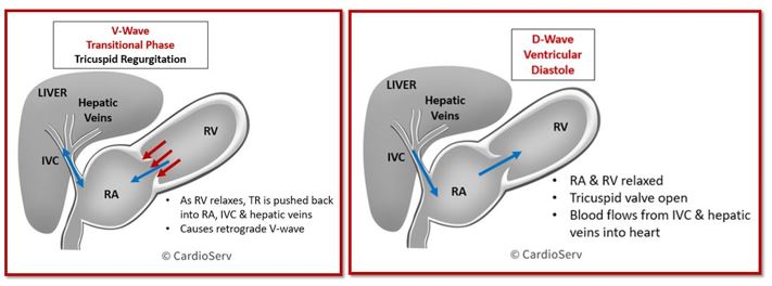 Hepatic Vein TR Cardiac Cycle