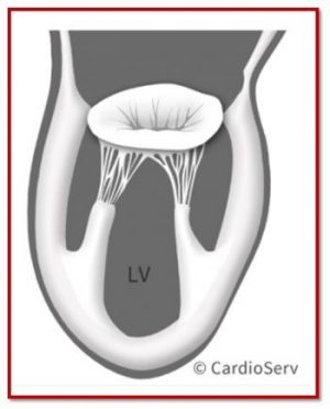 Mitral Valve Anatomy:  Name 5 Components!