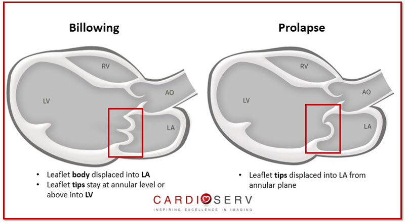 Essential Steps to Evaluating MR Etiologies