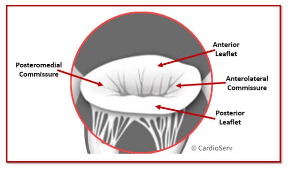 Mitral Valve Commissures