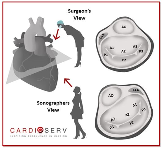 Finally… Mitral Valve Orientation Explained!