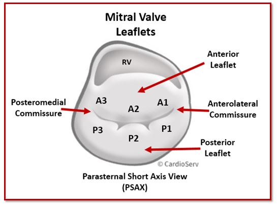 Mitral Valve Leaflets PSAX