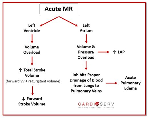 Acute Mitral Regurgitation Echo