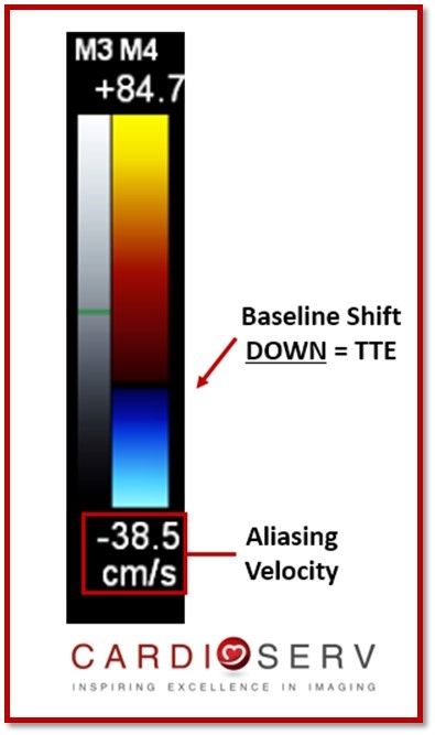 Color Doppler Baseline DOWN MR PISA TTE