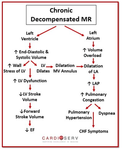 Chronic Decompensated Mitral Regurgitation Echo