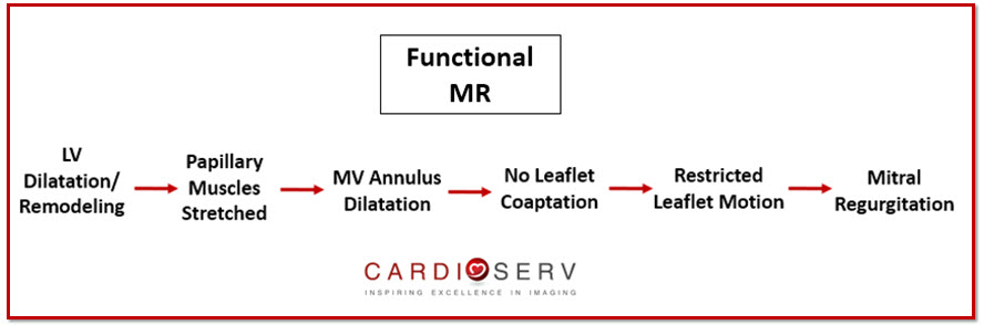 Functional Mitral Regurgitation Process Echo