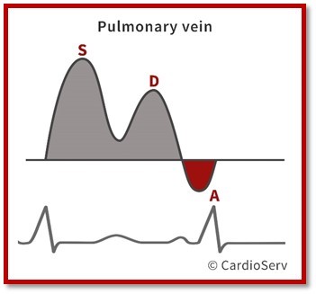 Normal Pulmonary Vein Waveform