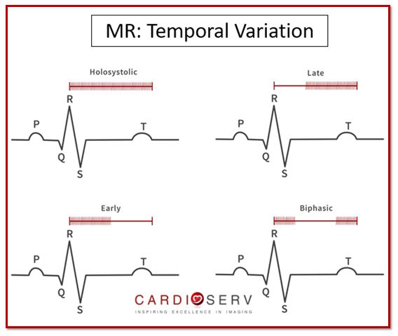 Mitral regurgitation Temporal variation EKG