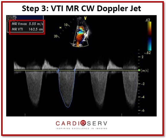 Step 3: MR CW VTI