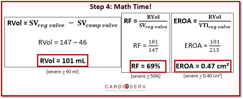 MR Stroke Volume Method Equations