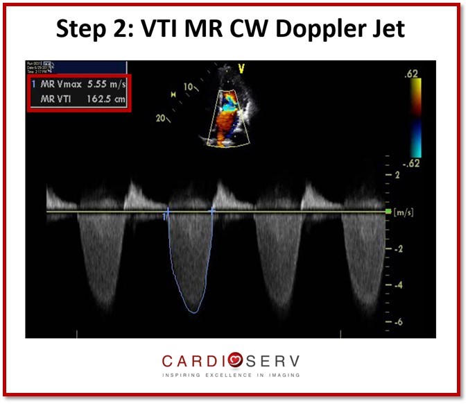 MR PISA CW VTI Doppler