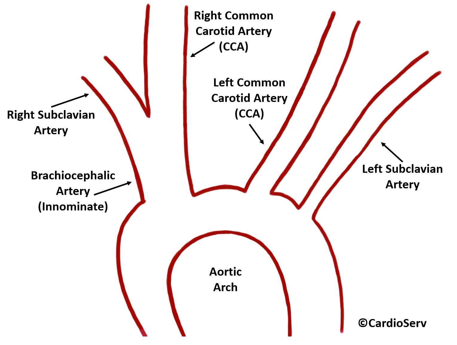 Aortic Arch