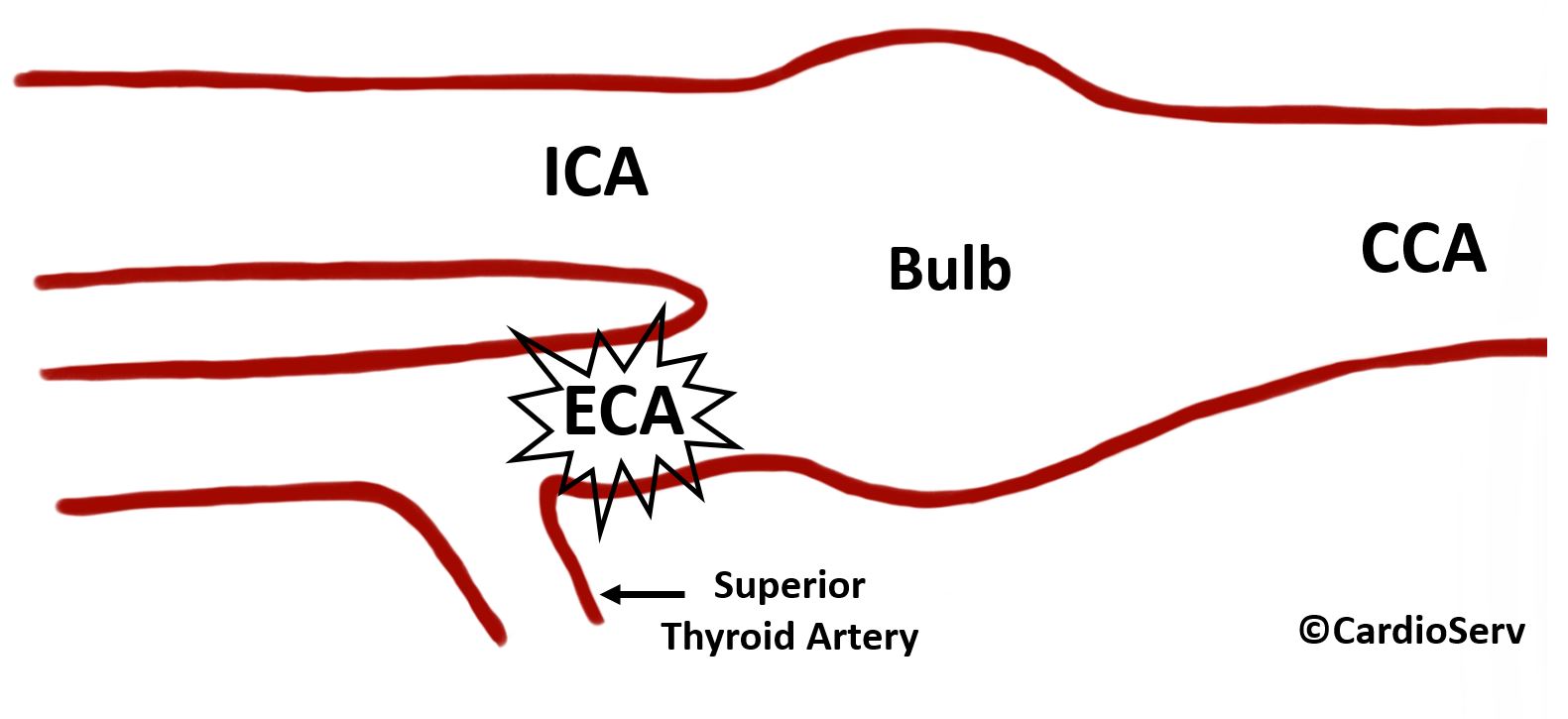 External Carotid Artery ECA