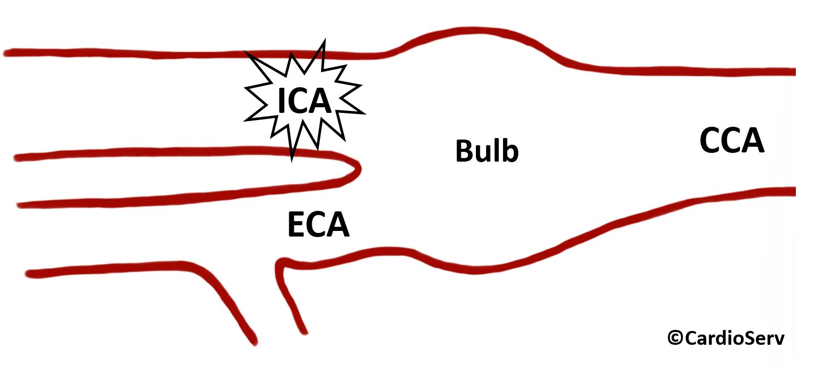 Internal Carotid Artery ICA