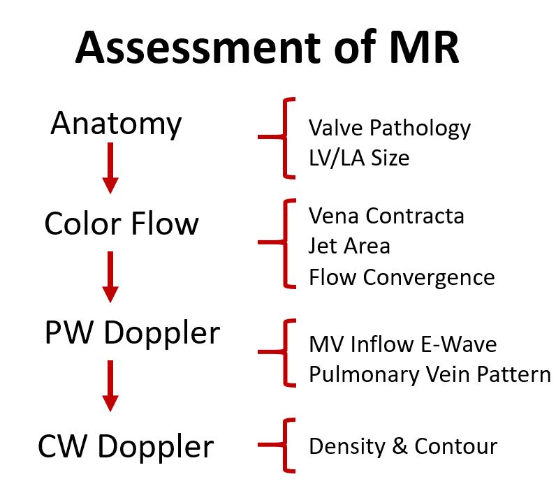 ASE’s Mitral Regurgitation Algorithm Simplified!