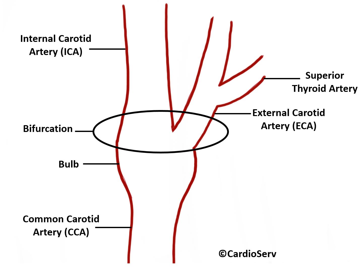 Carotid Artery Bifurcation 