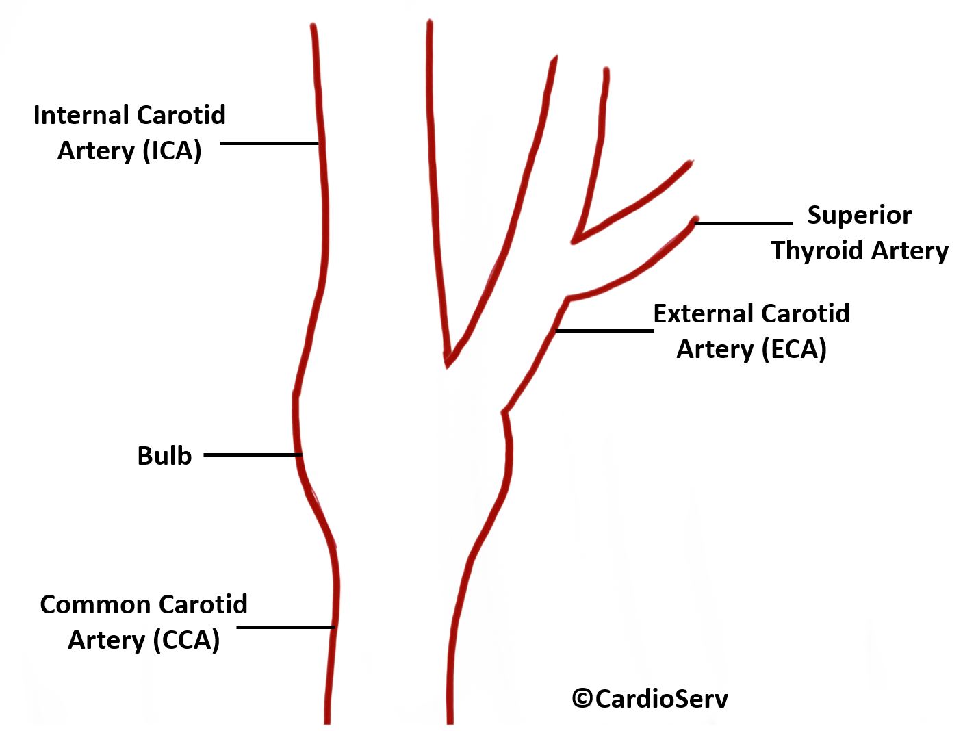 Common Carotid Artery (CCA)