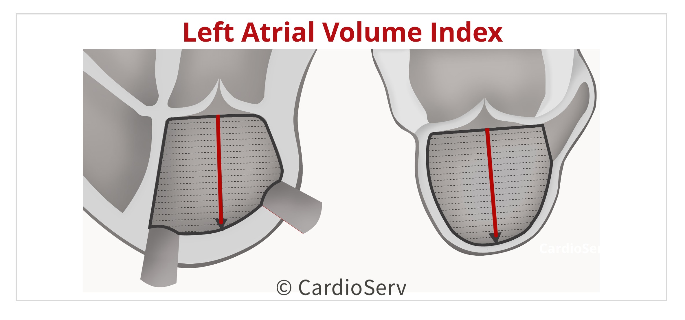 Left Atrial Volume Index 