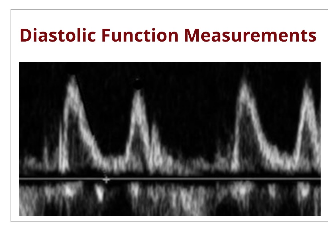 Correct Techniques to Acquire Diastology Measurements