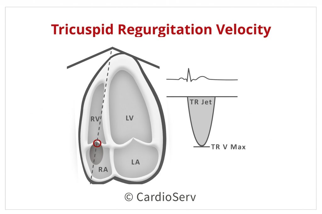 Tricuspid Regurgitation Velocity