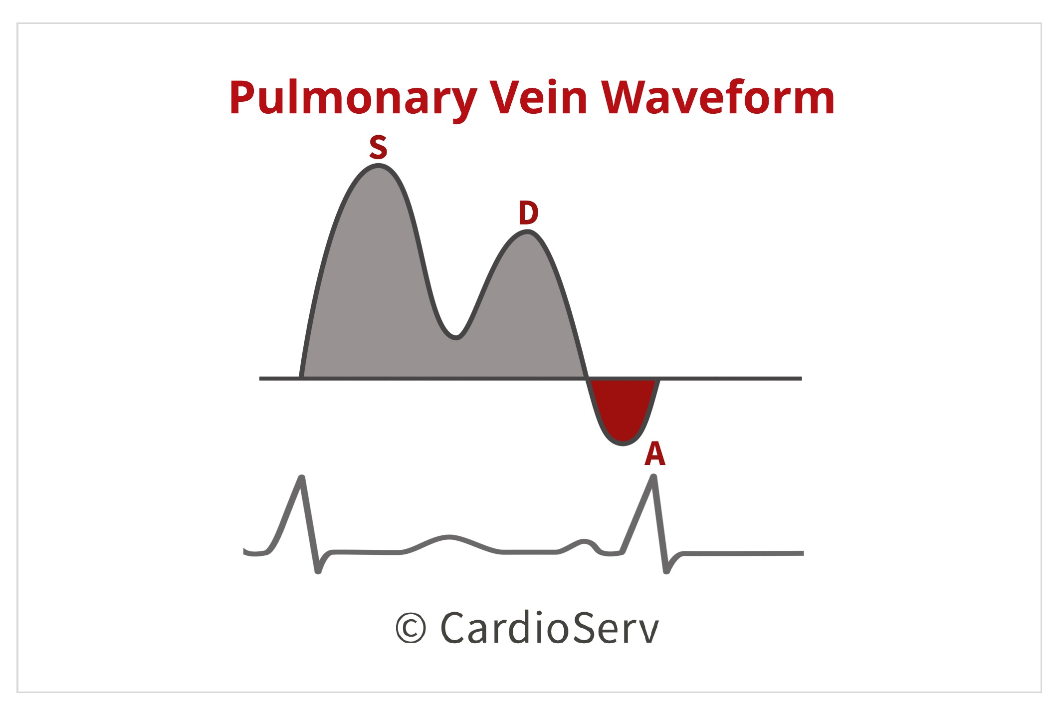 Pulmonary Venous Flow Pulmonary Venous Flow