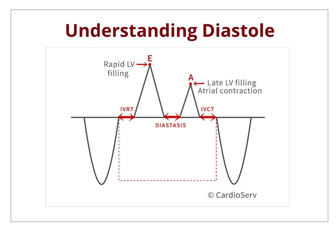 Understanding Diastole